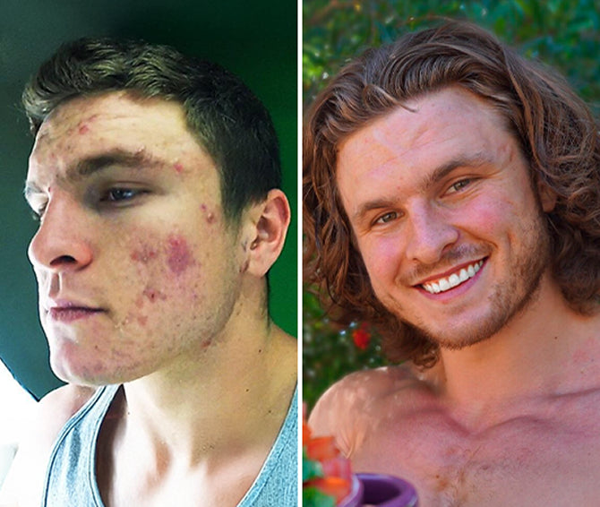 Before and after